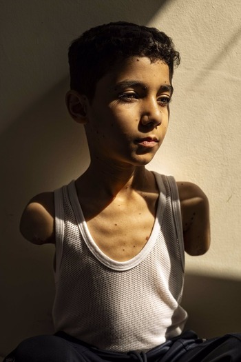 Un niño mutilado en un ataque en Gaza, foto del año