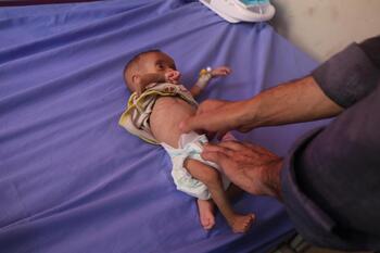 Las autoridades de Gaza alertan de 113 muertes por hambre