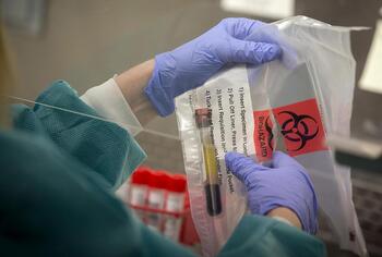 Carolina del Sur registra ya el peor brote de sarampión