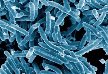 En España se notificaron 4.624 casos de tuberculosis en 2024